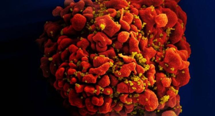 Científicos logran eliminar el VIH de las células con esta nueva tecnología