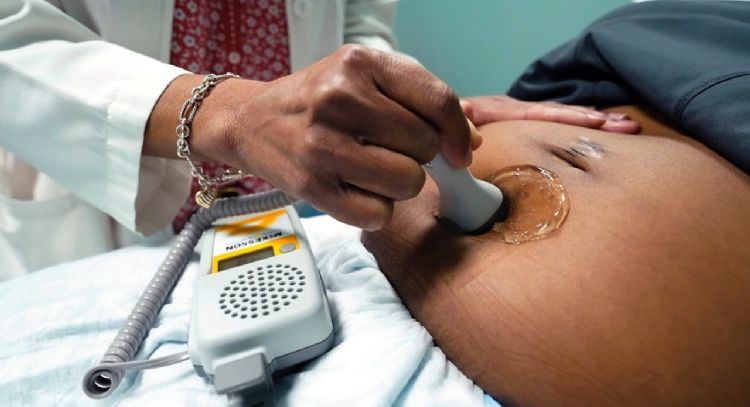 Nacimientos en EU en 2022 no volvieron a niveles previos a la pandemia