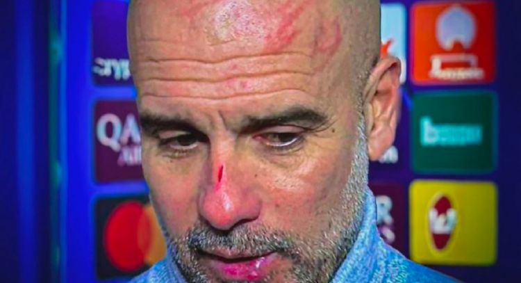Guardiola se vuelve viral por heridas en el rostro tras empate en Champions: 'Me quería hacer daño'