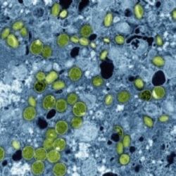 En 2030 más de mil millones de adolescentes tendrán mala alimentación, depresión y VIH: Lancet