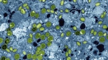 En 2030 más de mil millones de adolescentes tendrán mala alimentación, depresión y VIH: Lancet