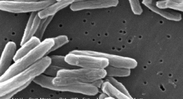 Repunta la tuberculosis: en 2023 alcanza la cifra de casos más alta en una década