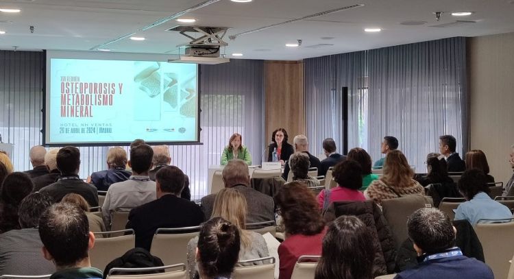 Estos factores aumentan el riesgo de osteoporosis