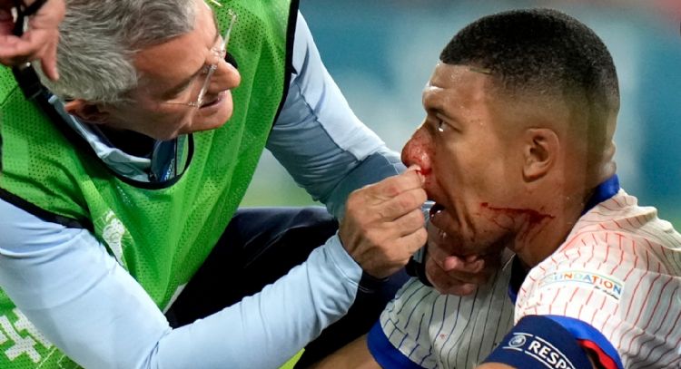 Así fue la jugada donde Mbappé se quebró la nariz en la Eurocopa (Video)