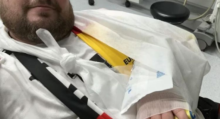 Niclas Füllkrug, futbolista alemán, fractura la mano de un aficionado con un balonazo