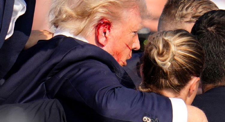 Trump y la bala mediática