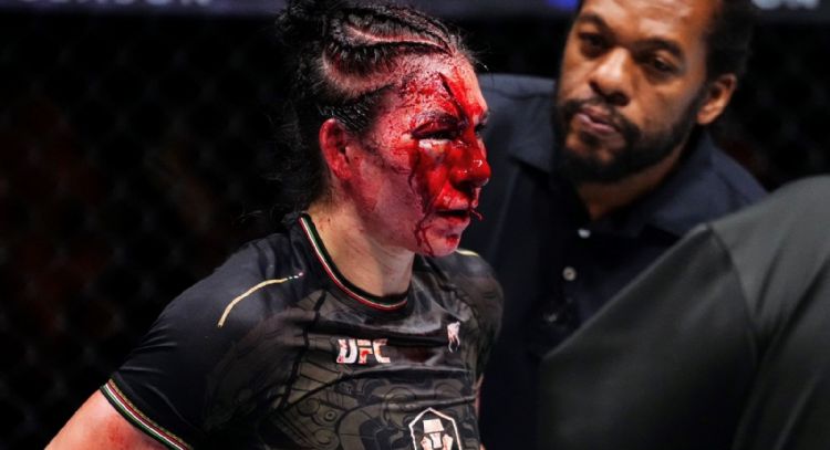 Irene Aldana sufre espeluznante corte en su rostro durante su pelea en la UFC (Video)
