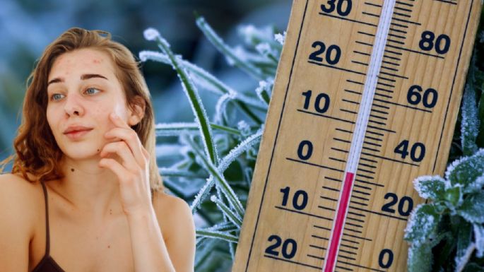 Nutrición y clima frío: alimentos que pueden ayudar a prevenir la piel seca en invierno