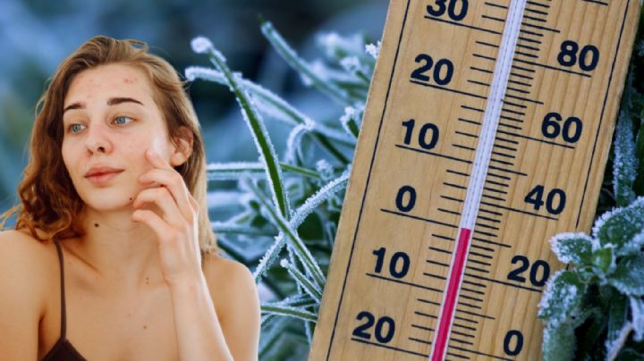 Nutrición y clima frío: alimentos que pueden ayudar a prevenir la piel seca en invierno