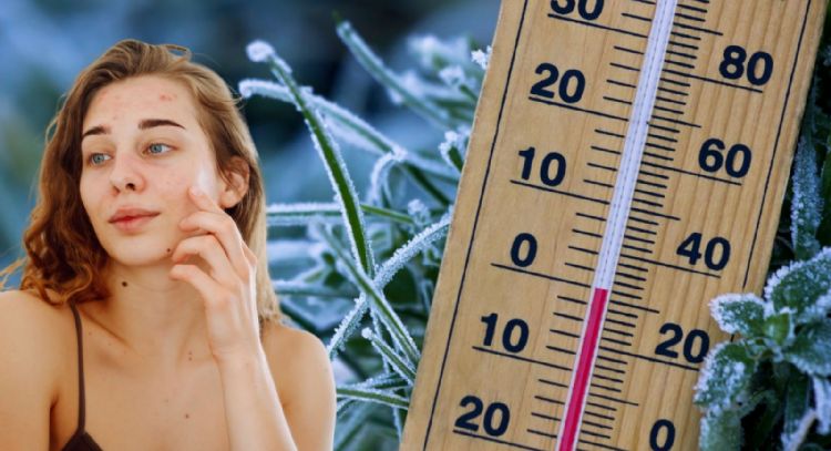 Nutrición y clima frío: alimentos que pueden ayudar a prevenir la piel seca en invierno