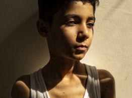 "¿Cómo podré abrazarte?": el retrato del niño gazatí con los brazos amputados, mejor foto del año