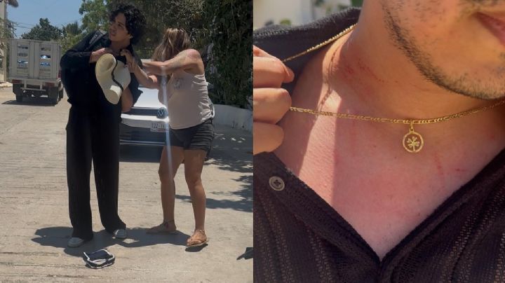 Lady Toallas: anfitriona de hotel golpeó a dos huéspedes por haberle entregado toallas con arena