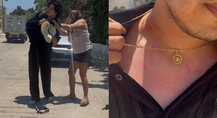 Lady Toallas: anfitriona de hotel golpeó a dos huéspedes por haberle entregado toallas con arena
