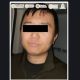 Zhi Dong Zhang: operador chino vinculado al CJNG y Cártel de Sinaloa se fuga en CDMX
