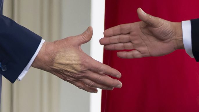 ¿En qué consiste la insuficiencia venosa crónica que padece Trump? Esto dijo su médico