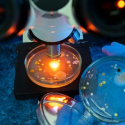 La bacteria "come carne" se encuentra en estos lugares: lo que debes saber para protegerte