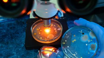 La bacteria "come carne" se encuentra en estos lugares: lo que debes saber para protegerte