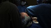 Foto ilustrativa de la nota titulada: IMSS de Querétaro extirpa tumor ovárico de casi 23 kilogramos a paciente de 37 años (Video)