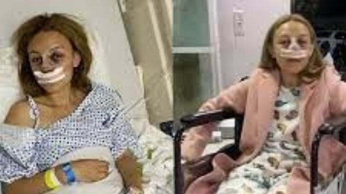 Fernanda Ramírez: sobreviviente de feminicidio; su agresor sigue prófugo desde 2023