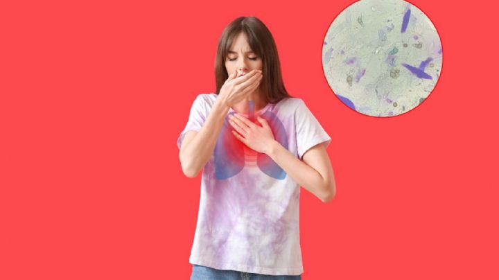 Tos persistente y pérdida de peso: señales que pueden indicar tuberculosis
