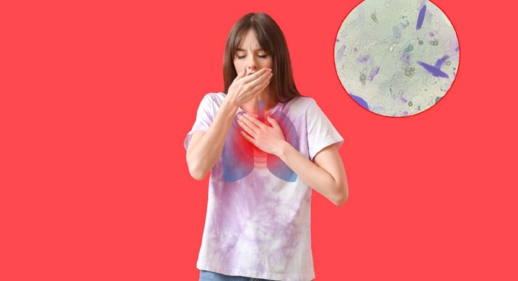 Tos persistente y pérdida de peso: señales que pueden indicar tuberculosis