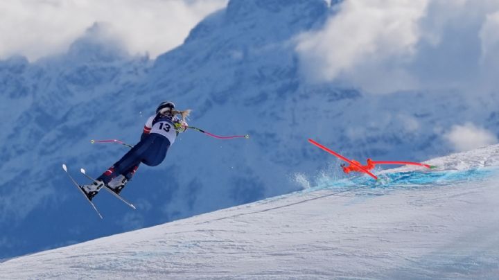 Lindsey Vonn sufre una caída en el descenso olímpico de invierno y es operada por una fractura