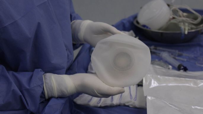 El libro “El cuerpo perfecto”, de Ana Lilia Pérez, destapa los riesgos de las cirugías estéticas