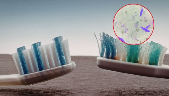 ¿Guardas mal tu cepillo? La UNAM explica cómo limpiarlo y cuándo cambiarlo