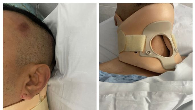 Agentes de la Fiscalía de Guanajuato propinan golpiza a reportero en Juventino Rosas