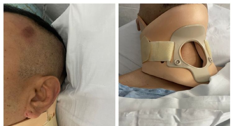 Agentes de la Fiscalía de Guanajuato propinan golpiza a reportero en Juventino Rosas