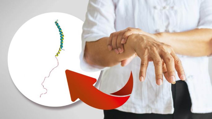 Extirpación del apéndice podría prevenir el mal del Parkinson: UNAM