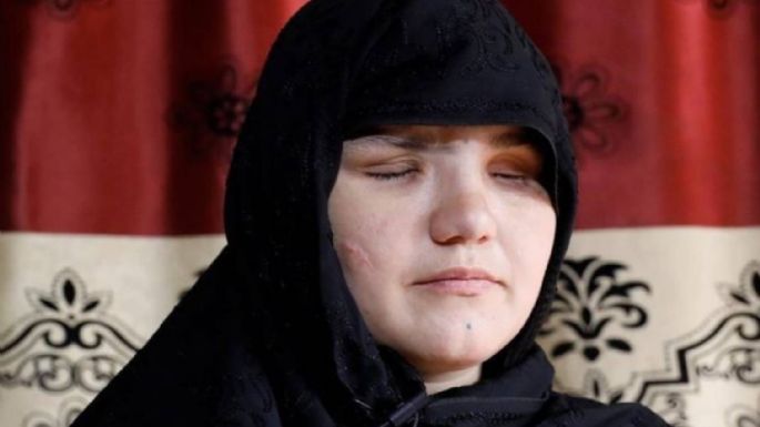 "A veces nuestros cuerpos alimentan a los perros":  testimonio de Khatera, sobreviviente del talibán