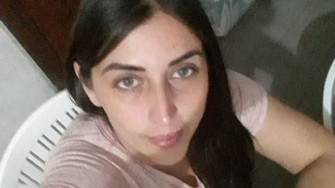 Claudia, la mujer que perdió el cartílago de la nariz por una prueba covid