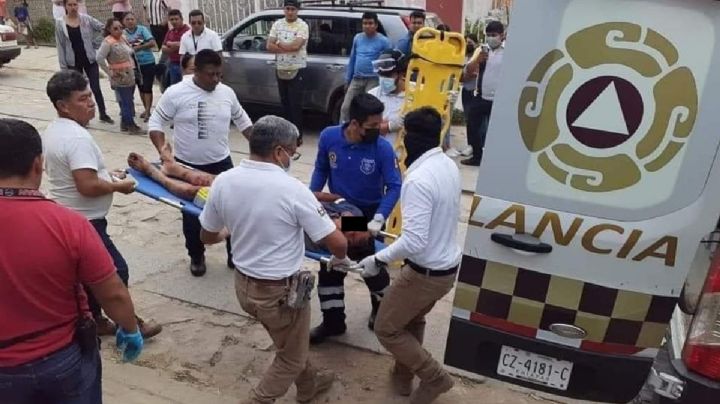 Pitbull casi le arranca un brazo a presunto ladrón en Chiapas; exigen no sacrificar al "héroe de Copoya"