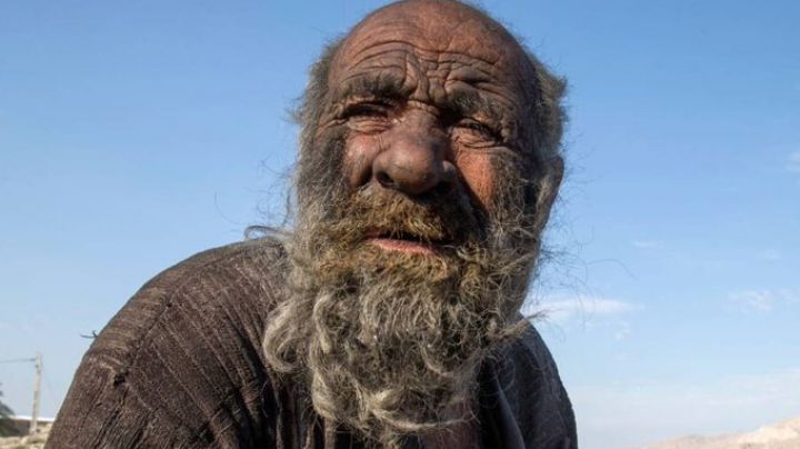 Muere “el hombre más sucio del mundo” poco después de bañarse por primera vez en 60 años