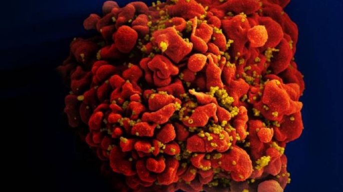 Científicos logran eliminar el VIH de las células con esta nueva tecnología