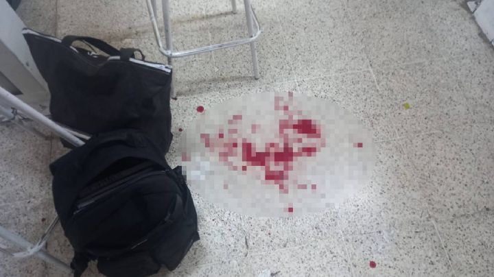 Alumno apuñala a maestro en secundaria de Huimanguillo, Tabasco; lo reportan grave