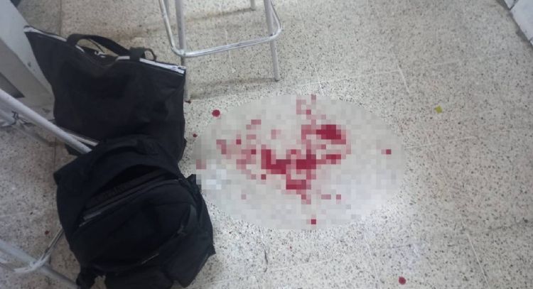 Alumno apuñala a maestro en secundaria de Huimanguillo, Tabasco; lo reportan grave