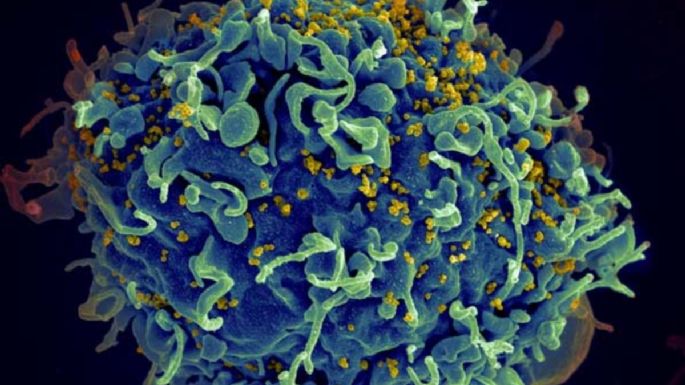 Descubren una variante del VIH más contagiosa y virulenta