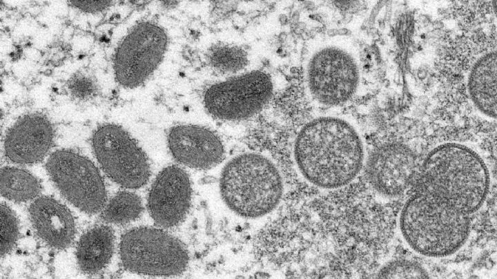 OMS confirma 80 casos de viruela del mono en 11 países