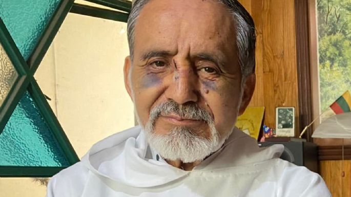 Sicarios andan por todas partes y nadie nos protege, dice el sacerdote golpeado Mateo Calvillo Paz