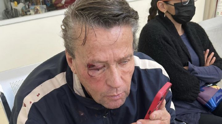 Alfredo Adame recibe golpiza afuera de su casa: "tengo desprendimiento de retina, no veo nada"
