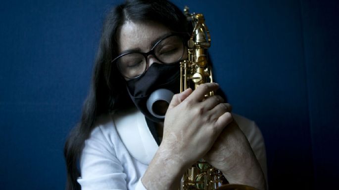 El saxofón, aliento para María Elena Ríos, la artista mexicana atacada con ácido