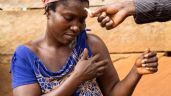 OMS pide acabar con "el estigma y discriminación" de la lepra para tratar los casos precozmente