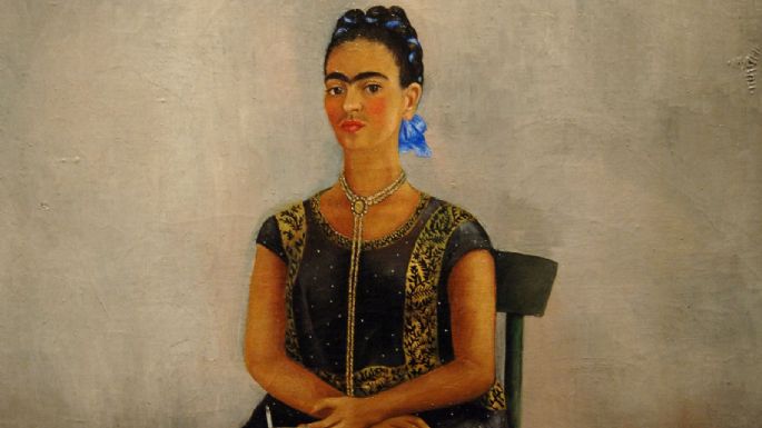 Diagnostican a Frida Kahlo del síndrome de la cola de caballo. ¿Qué es?