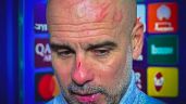 Guardiola se vuelve viral por heridas en el rostro tras empate en Champions: 'Me quería hacer daño'