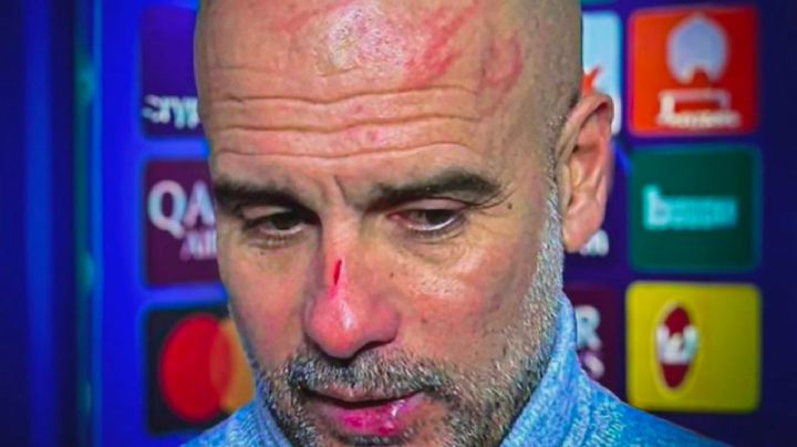 Guardiola se vuelve viral por heridas en el rostro tras empate en Champions: 'Me quería hacer daño'