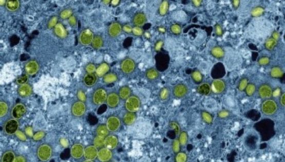 En 2030 más de mil millones de adolescentes tendrán mala alimentación, depresión y VIH: Lancet