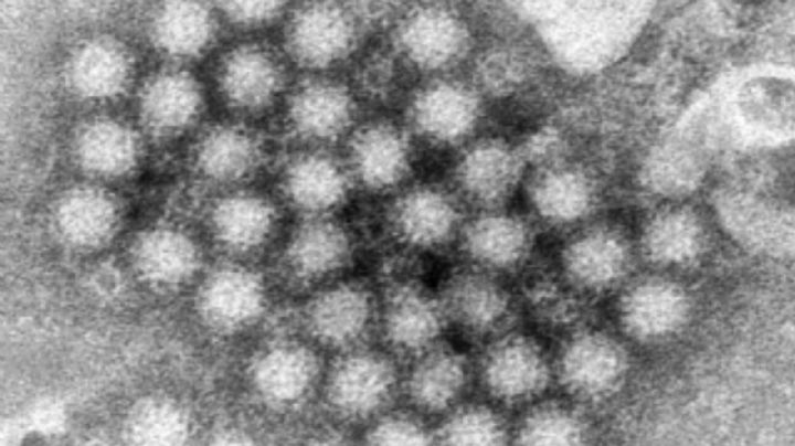 El norovirus regresa con fuerza y los casos en Estados Unidos aumentan notablemente