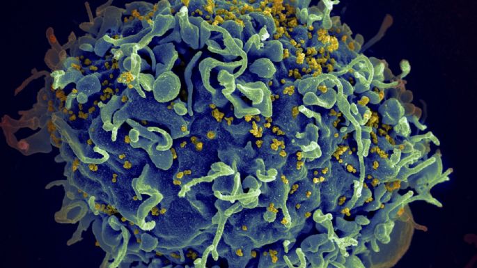 Identifican primeros casos documentados de VIH por "faciales vampíricos"